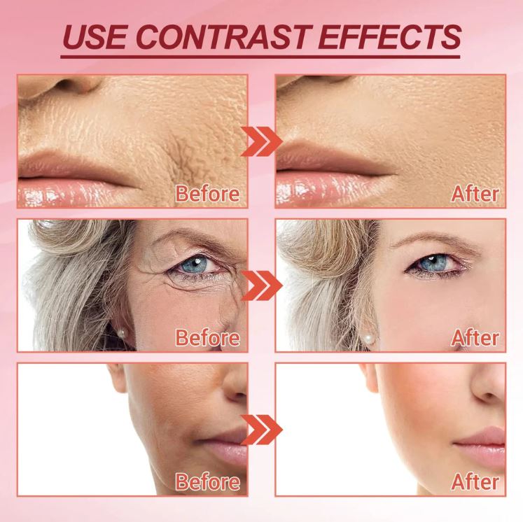 Dragón de la Juventud™:✨ “Renueva tu piel con el poder ancestral de la Sangre de Dragón”