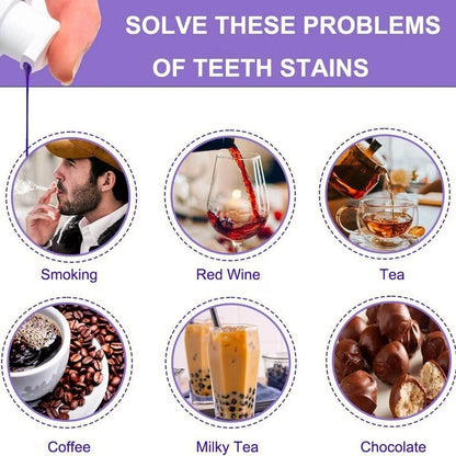 hismile - Blanqueador dental